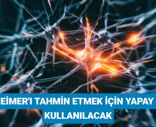 Bilim insanları, Alzheimer’ı tahmin etmek için 1 milyondan fazla beyni analiz edecek
